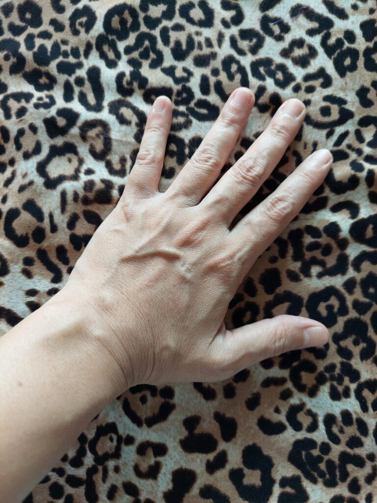 prominent hand veins
